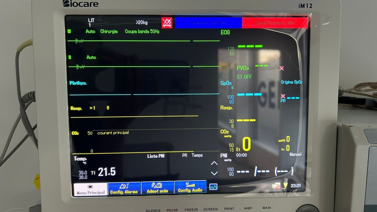 Monitoring d'anesthésie